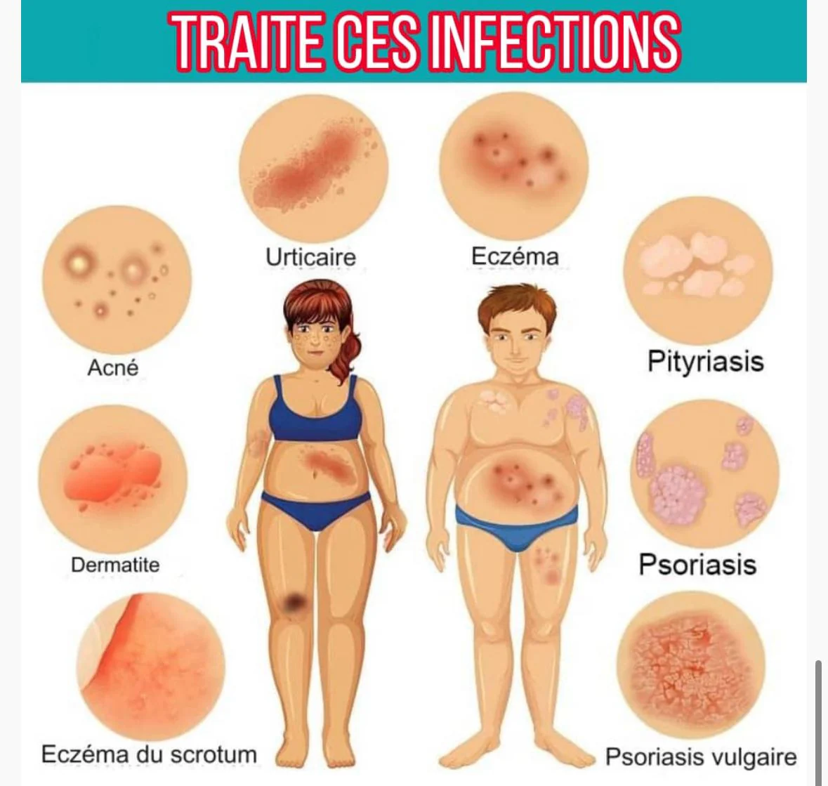 Eczéma-Kins Image 3